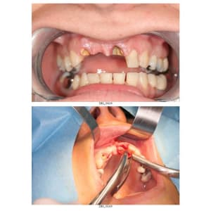 Planche contact 1 nznsns - Eugenol