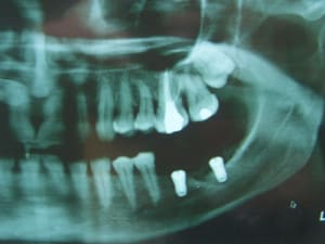 Positdental 022 u3cow3 - Eugenol