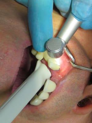 Positdental 181009 006 ltwxhf - Eugenol