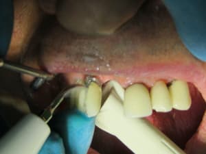 Positdental 181009 008 sa7bzk - Eugenol