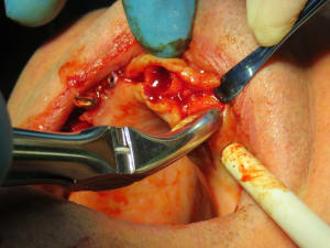 Positdental 181009 037 r1pjk4 - Eugenol