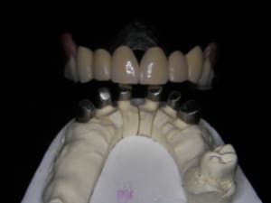Q  6  iqgwzr - Eugenol