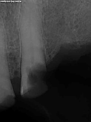 R15 ut2zsu - Eugenol