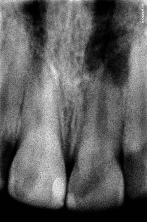 R1 mqfsvv - Eugenol