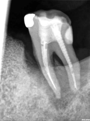 R69 fwgibc - Eugenol