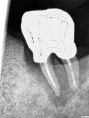 R70 d4vrxi - Eugenol