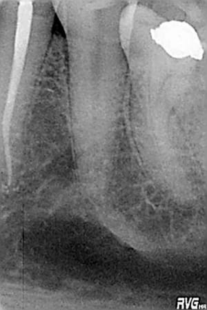 R7 koqeva - Eugenol