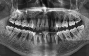 Semia mounia nvzs33 - Eugenol