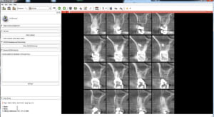 Slicer final cgihuo - Eugenol