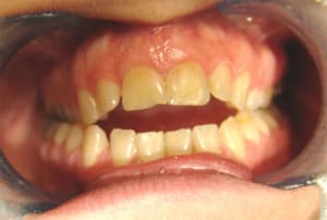 Sans titre 1 xhcrn5 - Eugenol