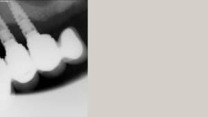 Sans titre2 lygg7o - Eugenol