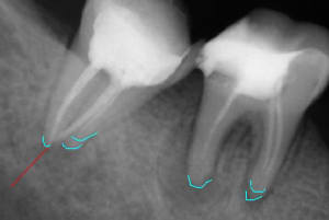 Sans titre is8zr9 - Eugenol