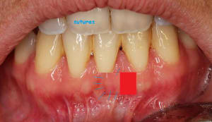 Sans titre kkkvhs - Eugenol