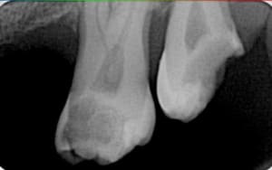 Sans titre mud4zk - Eugenol