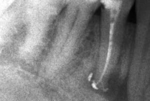 Screenshot002 brxr6c - Eugenol