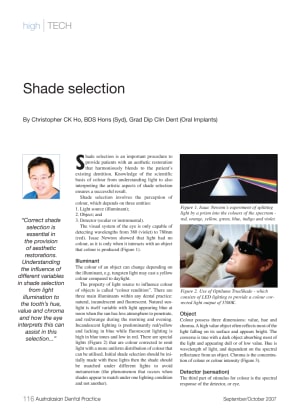 Shade selection yt0n4z - Eugenol