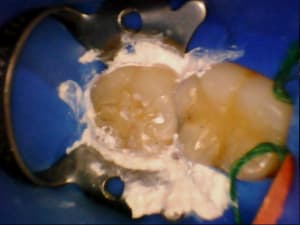 Stillcap0046 acd9gz - Eugenol