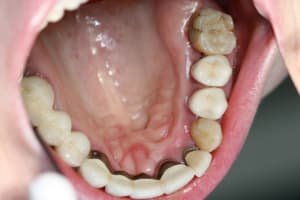 Untitled 3 sgth16 - Eugenol