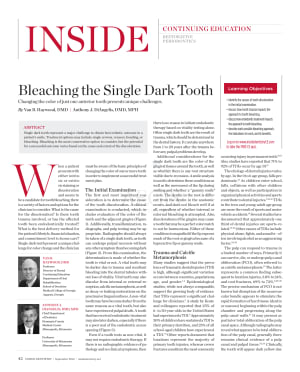 Van haywood 2010 single dark tooth bleaching odprky - Eugenol