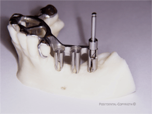 Www.positdental - Eugenol