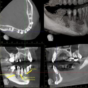 Xyzview 20140703 133108 gogz3z - Eugenol