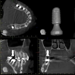 Xyzview 2015125234 nyhseu - Eugenol