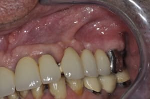  dsc1098 tyiw53 - Eugenol