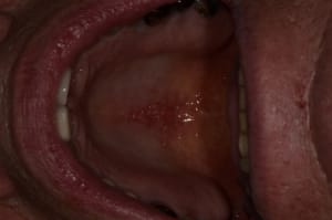  dsc1687 ivusnl - Eugenol