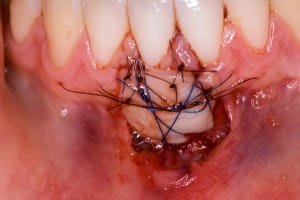  mg 0107 lazdoa - Eugenol