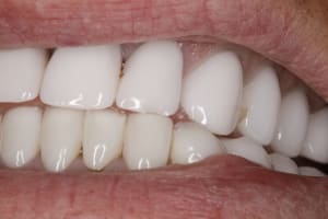  mg 1610 e8ljot - Eugenol