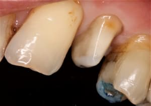  mg 1854 i9xlne - Eugenol