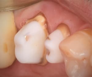  mg 1897 bhqurf - Eugenol