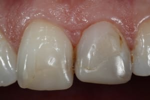  mg 3247 npkbqq - Eugenol