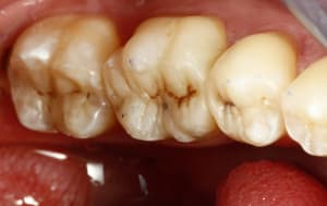  mg 5342 p5szbx - Eugenol