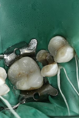  mg 6322 jkdewt - Eugenol