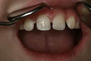  mg 7288 bjj9ad - Eugenol