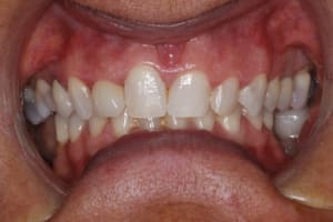  mg 8135 w29y4l - Eugenol