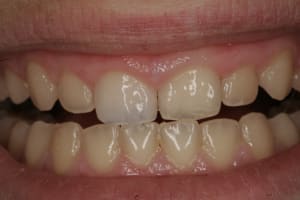  mg 8338 d0nkfe - Eugenol