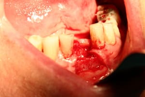 implant xiljmv - Eugenol