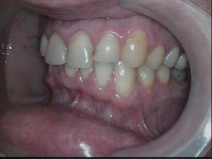  at 00 58 48 296  025 img s  vk80ge - Eugenol