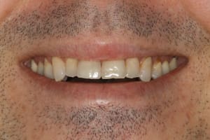 tat initial sourire xvebip - Eugenol