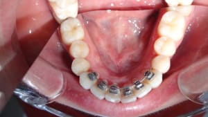 A10 duovrv - Eugenol