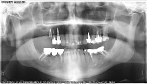 A6xukqmwzloitakyberxizfdtu79 - Eugenol