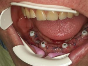 All on 4  large  o55lff - Eugenol