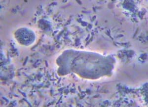 Amibe icpzis - Eugenol