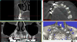 Aper u g n ral klb1id - Eugenol