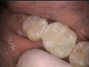 Après sc5jl0 - Eugenol
