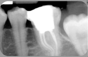 Autre incidence dkxbhy - Eugenol