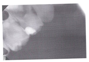 B4vliy7th6o1lqtwmoin - Eugenol