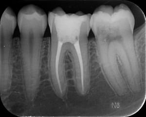 Bhgwzl2zni4qsw2eoiouomirqajw - Eugenol